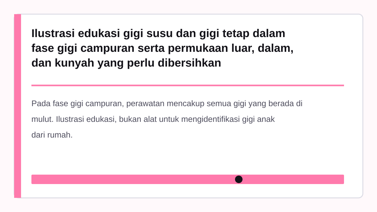 Ilustrasi edukasi gigi susu dan gigi tetap dalam fase gigi campuran serta permukaan luar, dalam, dan kunyah yang perlu dibersihkan